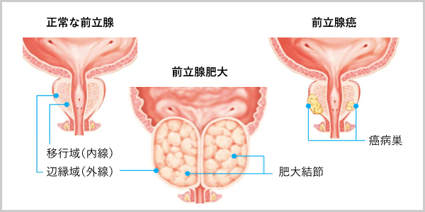 前立腺とは