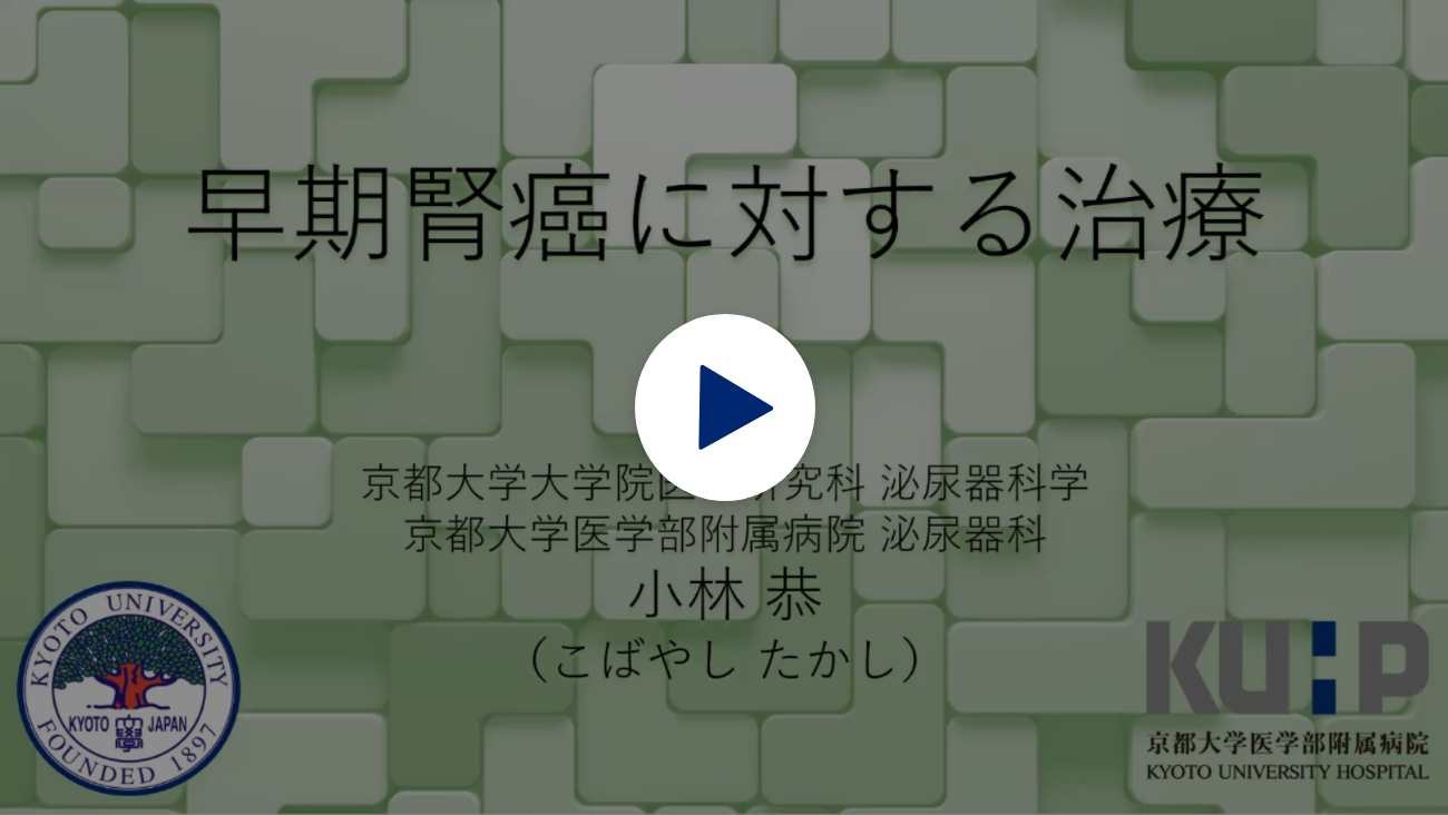 転移のない腎臓がんの治療 動画